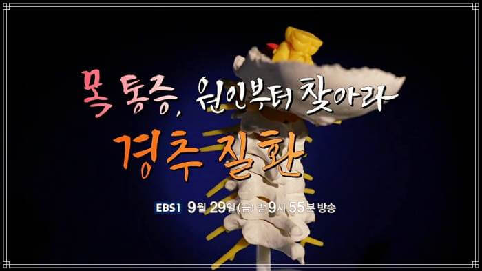 835회 명의 목 디스크 통증 류마티스 관절염 경추 질환 원인 수술 치료 방법 은평성모병원 신경외과 홍재택 교수 예약 추천 소개