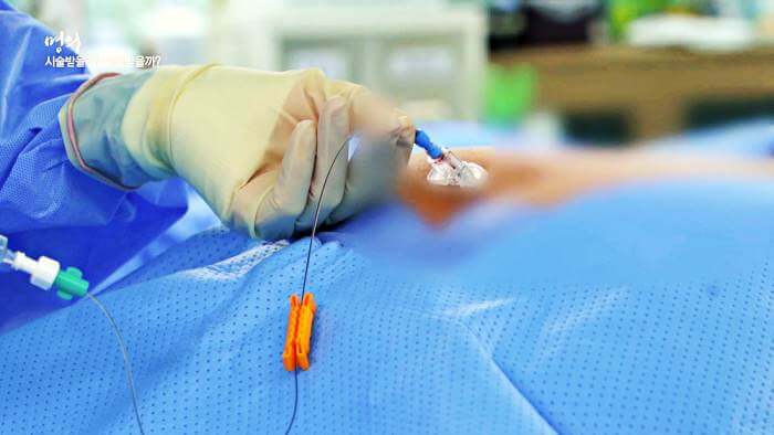 척추관협착증-추간판탈출증-허리통증