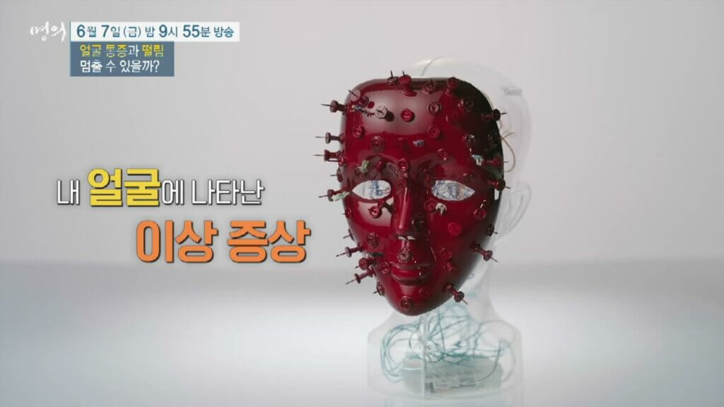 명의-얼굴-통증-떨림-삼차신경통