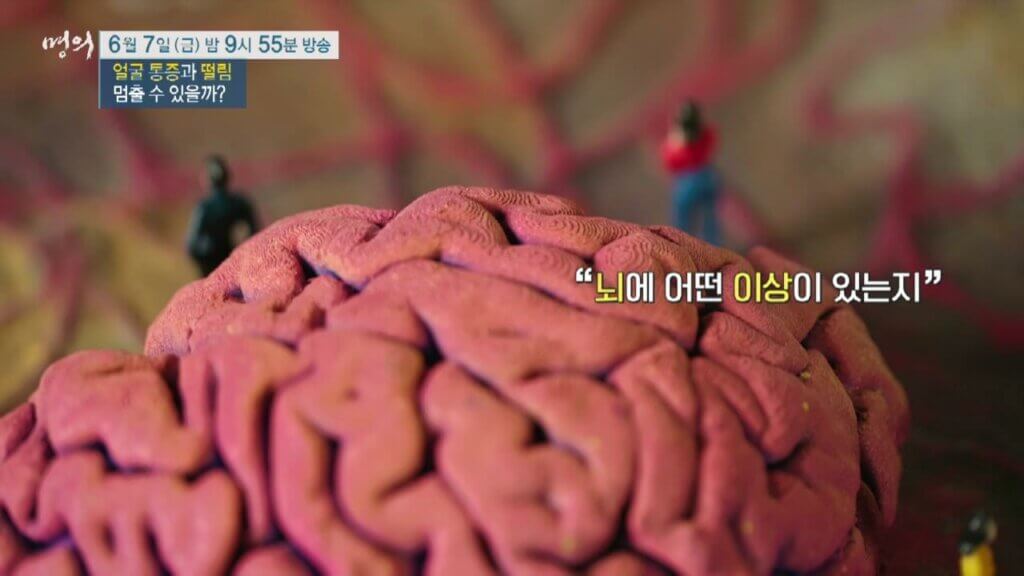 명의-얼굴-통증-떨림-삼차신경통