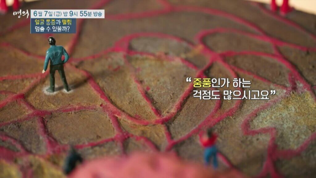 명의-얼굴-통증-떨림-삼차신경통