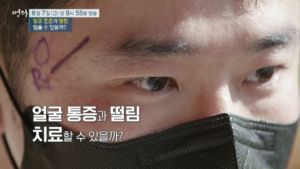 명의-얼굴-통증-떨림-삼차신경통