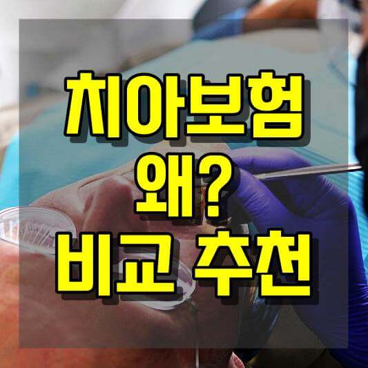 치아보험 가격대와 가입 이유 비교 추천